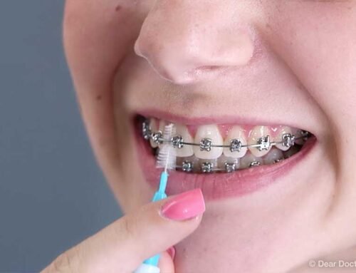 Smile Confidently: Finding the Best Orthodontist and Dental Clinic for Braces Near Me