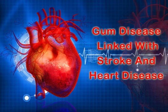 Gum Disease and Heart problems